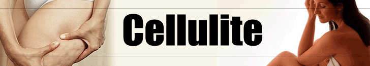 Cellulite header image