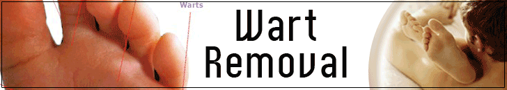 Wart Removal header image